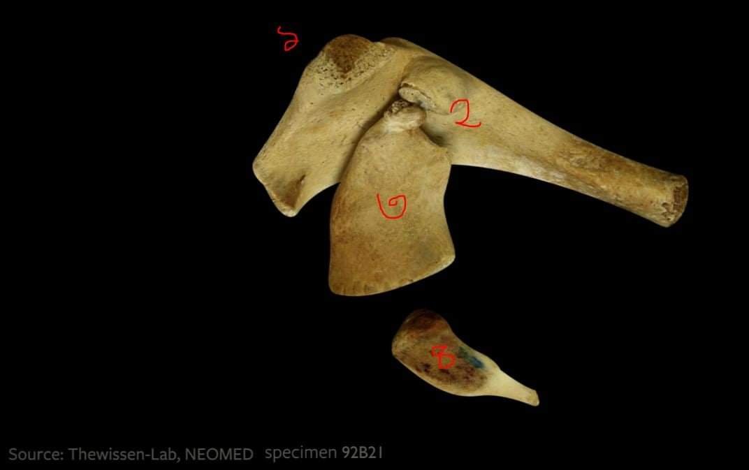 আধুনিক তিমির hindlimb